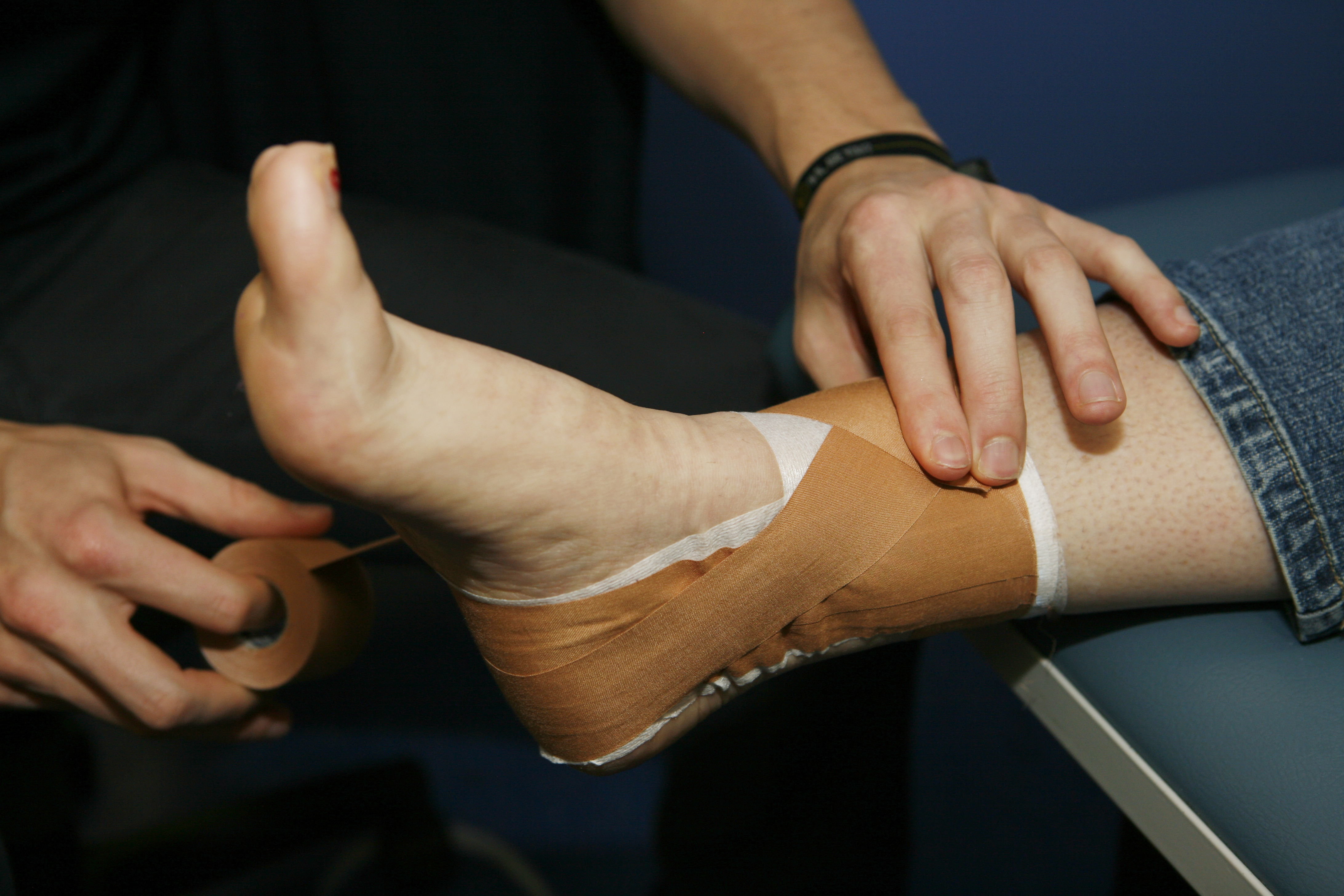 Treating Ankle Sprains with Bracing